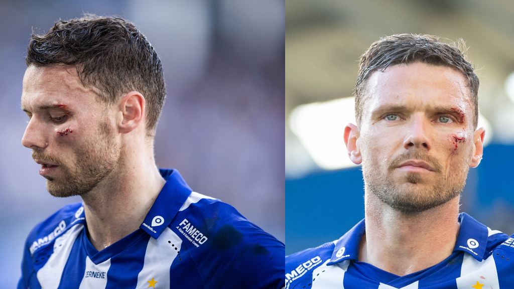 Marcus Berg mår bra efter smällen mot Varbergs BoIS