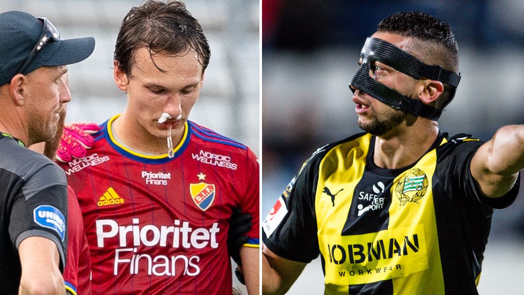 KLART: Så länge blir han borta – får specialgjuten mask