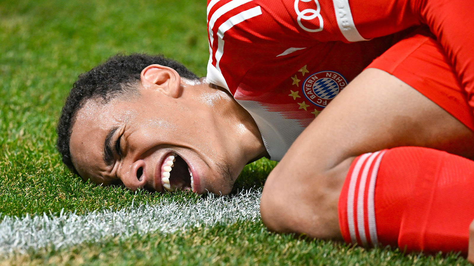 Bayerns besked: Musialas ben brutet – tvingas till operation