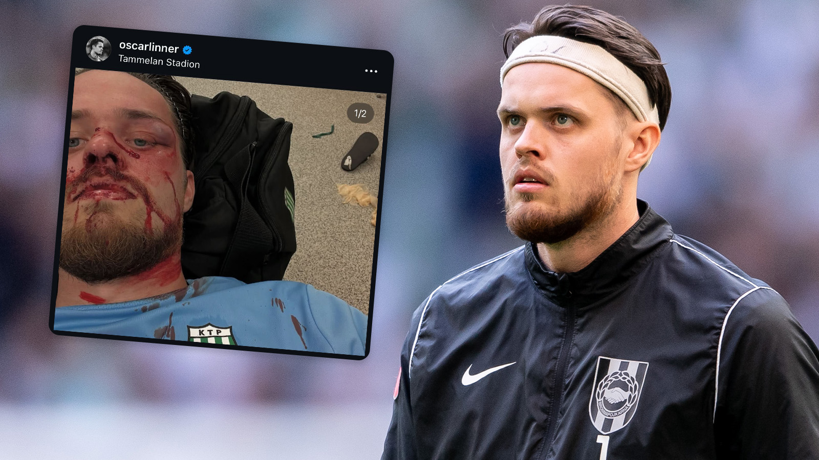 Oscar Linnér bröt i debuten – blodiga bilder: ”Ansiktet ommöblerat”