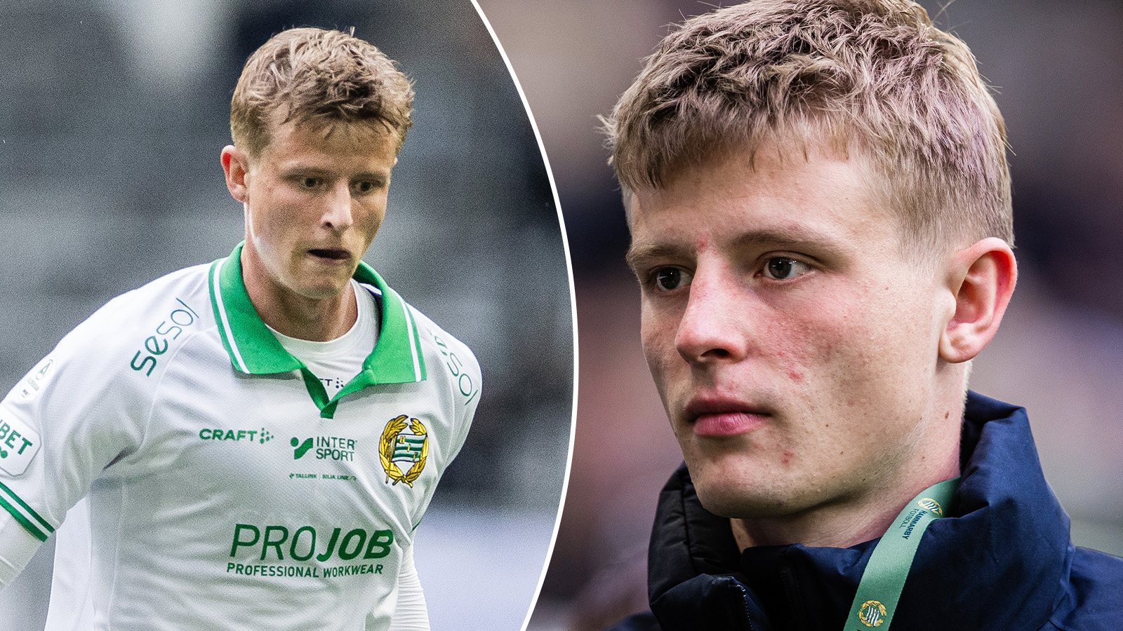 TV: Beskriver det värsta med skadan – FD har träffat Winther
