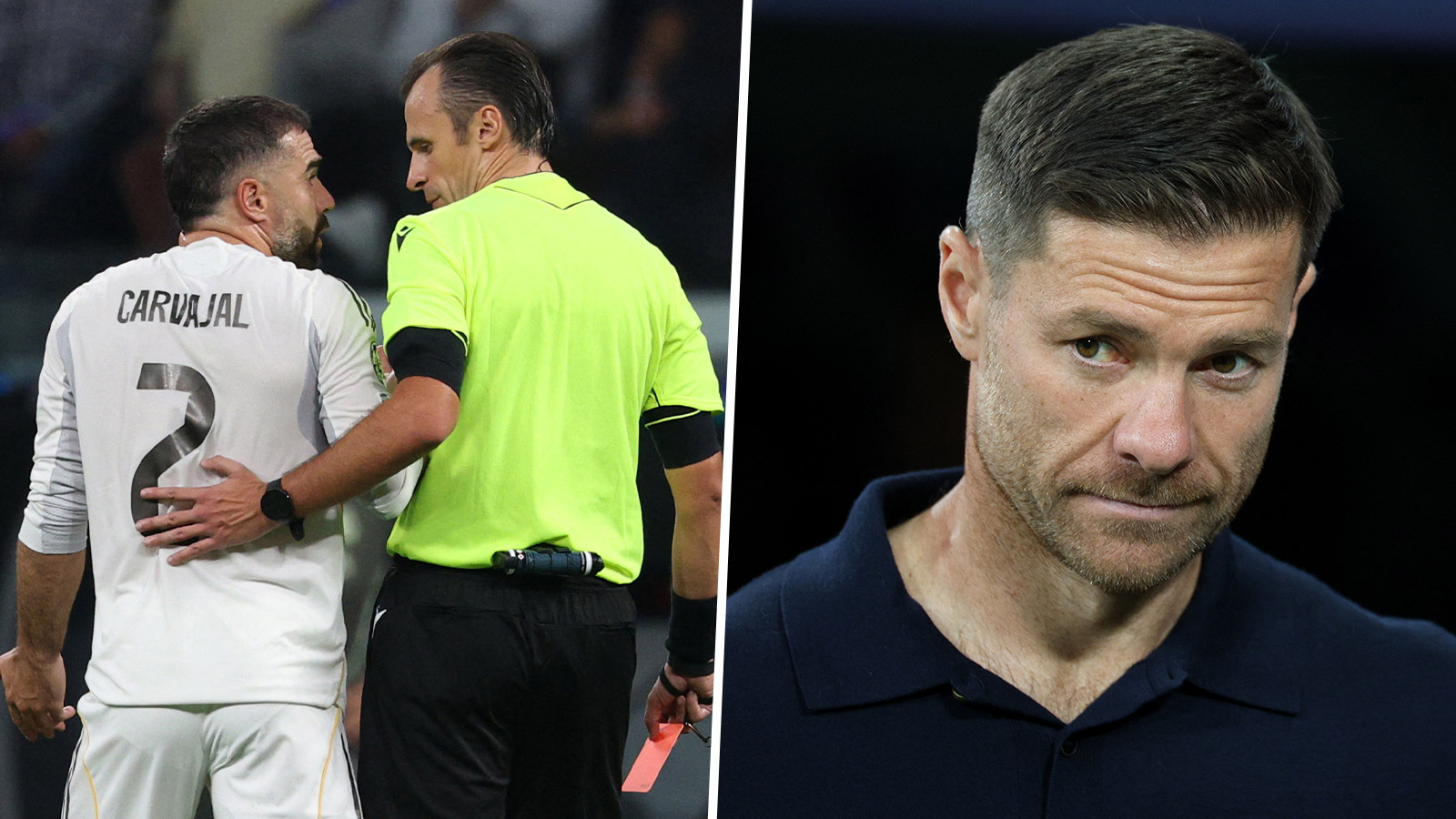 Efter skallningen – Carvajal sågas: ”Så dumt”