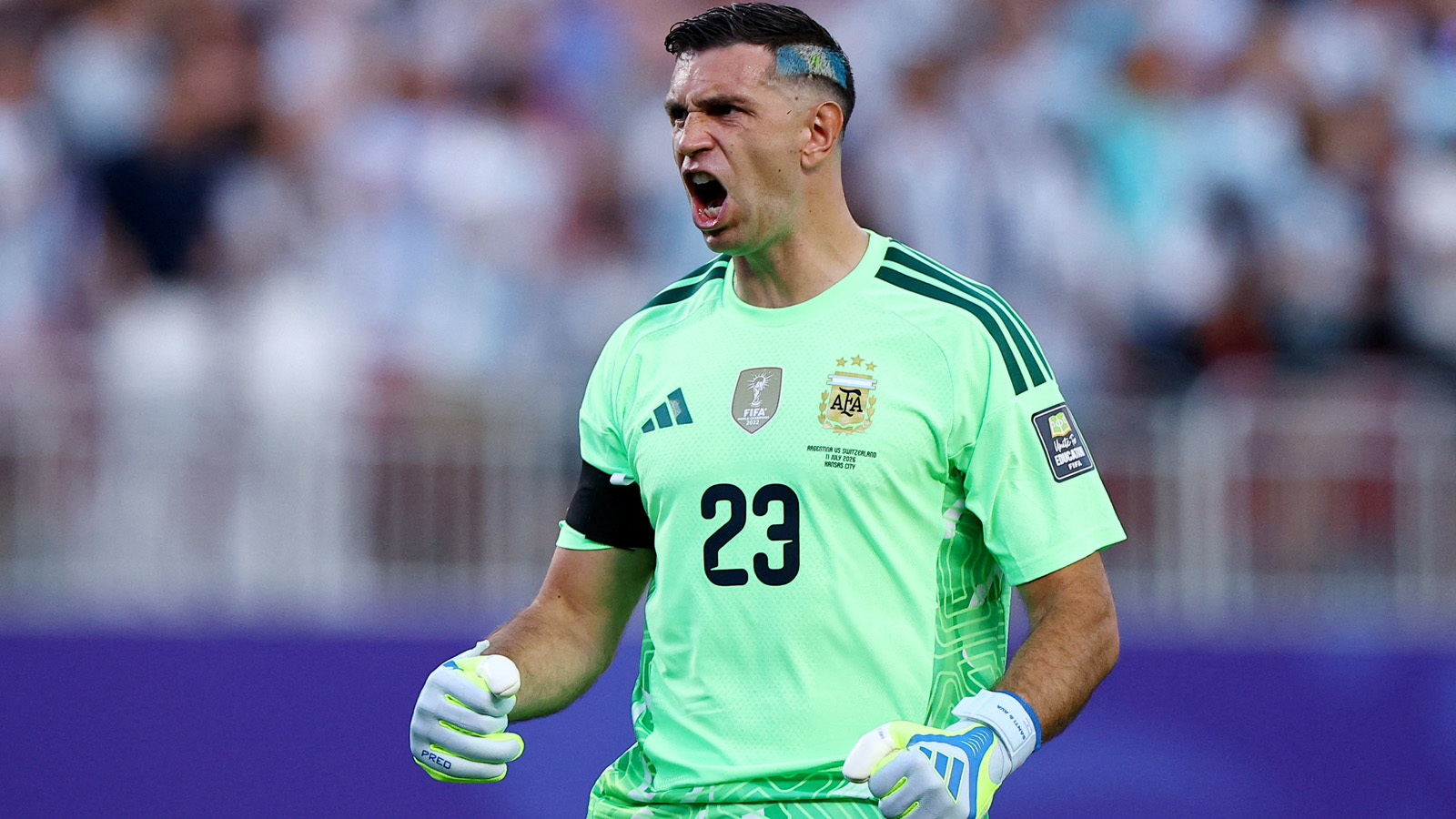 Spelar VM med brutet finger: ”Extremt smärtsamt”